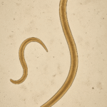 Classification of Ascaris lumbricoides