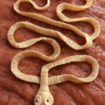 Taenia saginata (Beef Tapeworm)