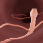 Taenia solium (Pork Tapeworm)