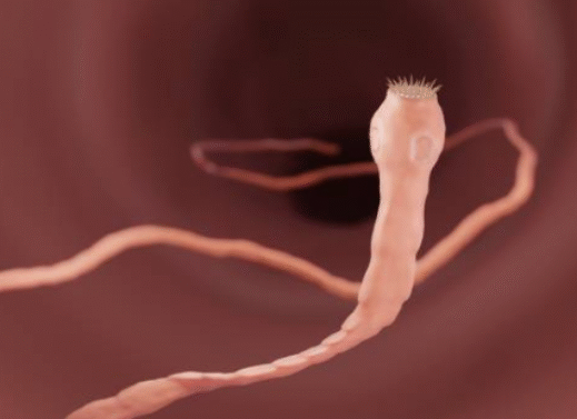 Taenia solium (Pork Tapeworm)