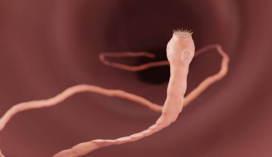 Taenia solium (Pork Tapeworm)
