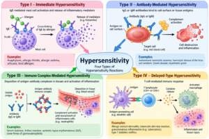 Hypersensitivity: Types, Mechanisms and Examples
